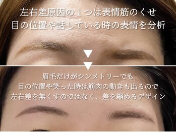 サルレ(Sarule)/左右差悩み2