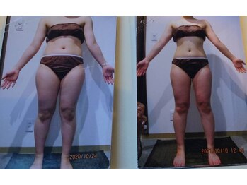 パーフェクトボディプレミアム 神戸三宮店(PERFECT BODY PREMIUM)/お客様 ビフォーアフター(5)