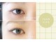 アルバ(ALBA)の写真