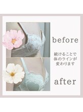 ビューティフィール アンド アリサナ(Beauty Feel&Arisana)/症例写真　バストケア