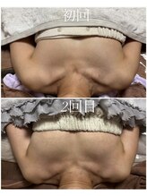 エース(A)/デコルテからふっくらバスト