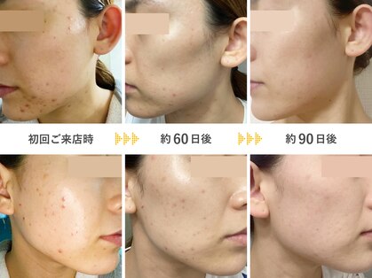 オーシャンブルー 福岡店(OCEAN BLUE フェイシャル&ボディ)の写真