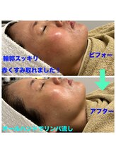 グリーンルーム(green room)/オールハンドで【素肌育成】