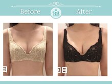 美人バスト 岡崎店/【バストアップ★】症例