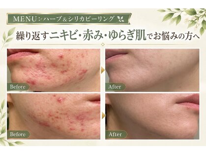 レヴェイユ(Reveil)の写真