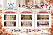 ホワイトニングショップ 春日井店(whitening shop)
