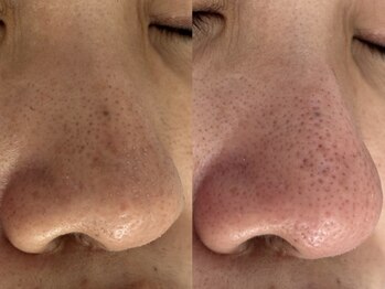 サクラ 伊勢原店(SAKURA)/