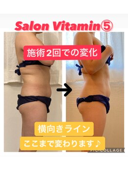 サロン ビタミンファイブ(Salon Vitamin5)/骨キワまで意識したアプローチ！