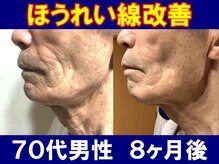 ユリシード 大阪分院(Ulyseeed)/たった数回でこんなに変わる☆彡