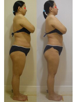 アルマ 芦屋(ALMA)/気になるところを狙い撃ち!