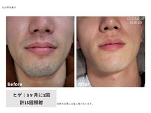 ラッシュ(RUSH)/出張の合間に3ヵ月に1回で完了！