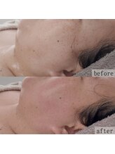 ヴェルシック(Belchic)/諦めかけている方は必見