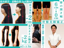 美骨矯正 ステキプロ(SUTEKI pro)