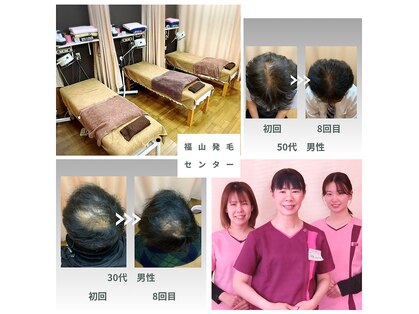 福山発毛センターの写真