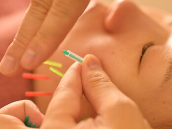 アロエベル(aloe Belle)/美容鍼