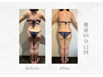 エヴァーグレース 三河安城店(EVER GRACE)/【ボディー管理】痩身60