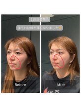 サリエ(S'allier)/お客様のビフォーアフター