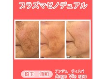 アンジュ ヴィスパ(Ange Vie Spa)の雰囲気（あらゆる肌悩みに！ニキビケア、シミ改善、毛穴ケア、たるみ改善）