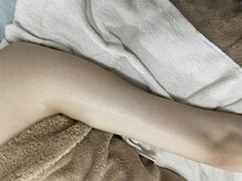 ナノハナ/鹿沼市全身脱毛美容室ナノハナ