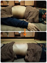 パプリカ(Paprika)/施術Before→After