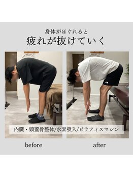 整体院 バイオリハ(Bio_Reha.)/【腰痛】