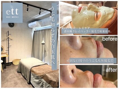 エット(ett)の写真