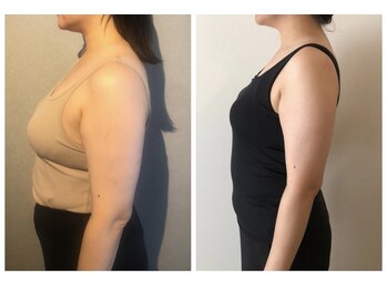 ミチカケ トリムリターン那覇市店/目指せ姿勢美人！