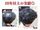 スーパースカルプ 大津店(SuperScalp)の写真