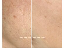 セレーノ/ビフォーアフターのご紹介