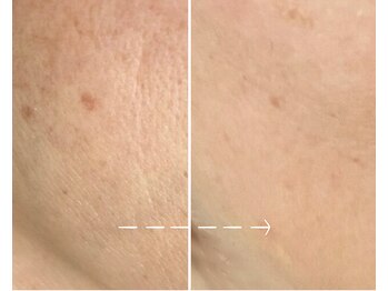 セレーノ/ビフォーアフターのご紹介