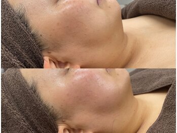 ミレット(Miretto)/ジョジアンロール【ファシア】