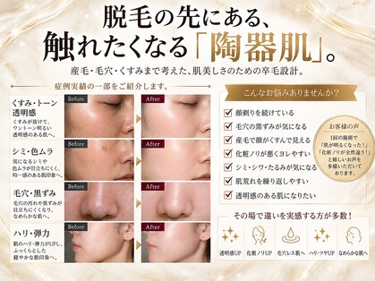 ベルアンドヘルス 千葉(BELL&HEALTH)の写真