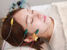 カズエナカムラ(KAZUE NAKAMURA)/人気の電気を流す美容鍼