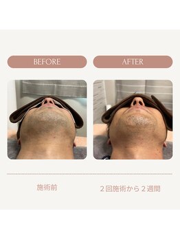 ラポール(Rapport)/