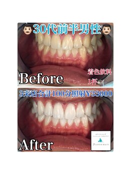 ホワイトニングビューティ 三川店/カフェ好きさん必見☆