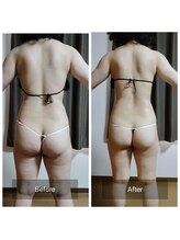 スリール(sourire)/ビフォーアフター