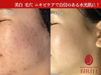 バース(Birth...)の写真