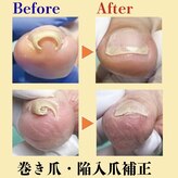 巻き爪補正店 赤羽店