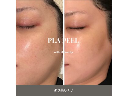 ウィズ ユー ビューティ(with U beauty)の写真