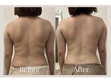 リネア(Linea)の雰囲気（背中スッキリ！ウエストや上半身ダイエットも得意です◎施術2回）
