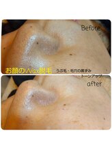 トリニティスペース(TrinitySpace)/フェイシャルワックス