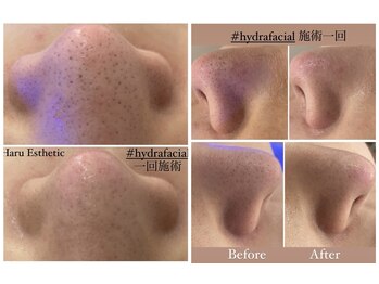 ハルエステティック 銀座(Haru Esthetic)