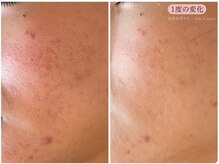 レスイズモア 恵比寿(less is more.)/一度の変化[はちみつパック付]