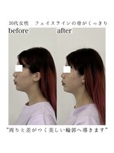 ヴェルシック(Belchic)/当店で美しい横顔造れます