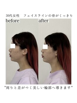 ヴェルシック(Belchic)/当店で美しい横顔造れます