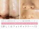 クリアー(CLEAR.)の写真