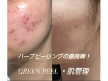 シューン(schon)