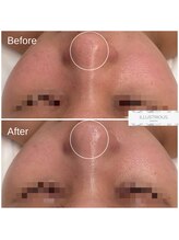 クレア(Clair)/イラストリアス症例