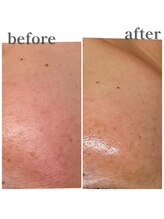 アイラッシュ シェリ(cheri)/ララピール