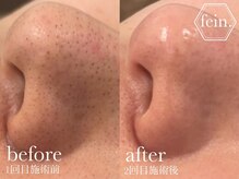 フェイン 青山店(fein.)